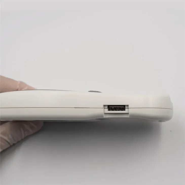 Noninvasive Blood Hemoglobin Meter Monitoring System